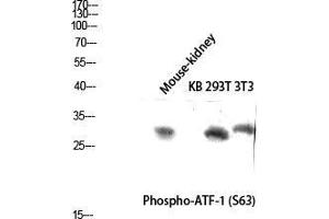 Western Blot (WB) analysis of Mouse Kidney KB 293T 3T3 lysis using Phospho-ATF-1 (S63) antibody. (AFT1 antibody  (pSer63))
