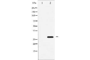 Western blot analysis of ATF1 expression in COLO205 whole cell lysates,The lane on the left is treated with the antigen-specific peptide. (AFT1 antibody  (Internal Region))