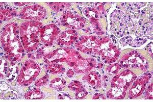 Human Kidney, Tubules: Formalin-Fixed, Paraffin-Embedded (FFPE) (Vinculin antibody  (AA 786-835))