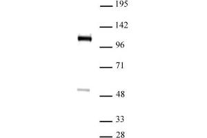 FOXM1 antibody (pAb) tested by Western blot. (FOXM1 antibody  (C-Term))