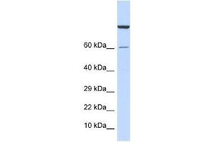 Western Blot showing ZNF251 antibody used at a concentration of 1-2 ug/ml to detect its target protein. (ZNF251 antibody  (Middle Region))