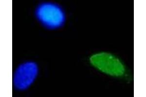 Immunofluorescence (IF) image for anti-Human Papilloma Virus Type 11 (HPV-11) (AA 83-201) antibody (ABIN781774) (Human Papilloma Virus Type 11 (HPV-11) (AA 83-201) antibody)