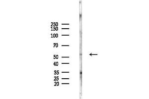 Western blot analysis of lysates from EC304 cells(heat-shock,45 min treatment), using Phospho-TFEB (Ser142) Antibody at 1/1000 dilution.