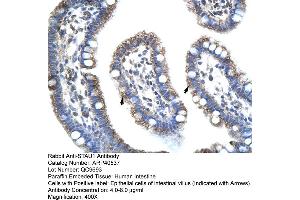 Rabbit Anti-STAU1 Antibody  Paraffin Embedded Tissue: Human Intestine Cellular Data: Epithelial cells of intestinal villas Antibody Concentration: 4. (STAU1/Staufen antibody  (N-Term))