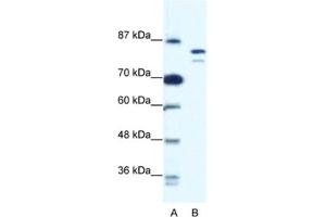 Western Blotting (WB) image for anti-Minichromosome Maintenance Deficient 8 (MCM8) antibody (ABIN2461402) (MCM8 antibody)