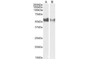 ABIN6391370 (1µg/ml) staining of Human Lymph Node (A) and (0. (LAG3 antibody  (Internal Region))