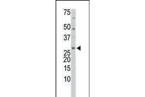 Antibody is used in Western blot to detect TrxL in HL-60 cell lysate. (TXNL1 antibody  (C-Term, Trp32))