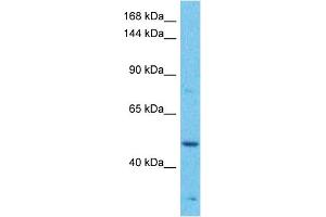 Host:  Rabbit  Target Name:  MAP3K1  Sample Tissue:  Human Jurkat Whole Cell  Antibody Dilution:  1ug/ml (MAP3K1 antibody  (C-Term))