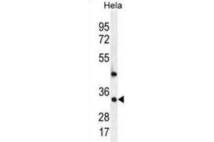 Western Blotting (WB) image for anti-Mediator Complex Subunit 7 (MED7) antibody (ABIN2996463) (MED7 antibody)