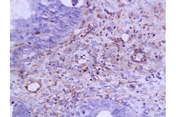 VEGF antibody  (AA 27-120)