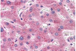 Liver, Human: Formalin-Fixed, Paraffin-Embedded (FFPE) (PROC antibody)