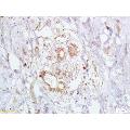anti-Breast Cancer 2, Early Onset (BRCA2) (AA 21-130) antibody