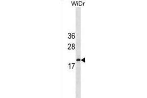 Western Blotting (WB) image for anti-Interferon, alpha 5 (IFNA5) antibody (ABIN3000243) (IFNA5 antibody)