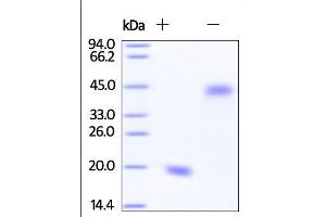 Human VEGF121 on SDS-PAGE under reducing (R) and no-reducing (NR) conditions. (VEGF121 Protein (AA 27-147))