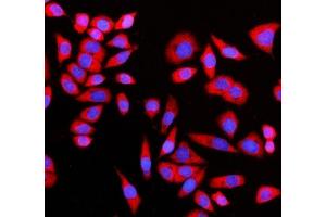 IF analysis of GIGYF2 using anti-GIGYF2 antibody (ABIN7601679). (GIGYF2 antibody  (AA 413-1299))