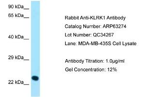 Western Blotting (WB) image for anti-Killer Cell Lectin-Like Receptor Subfamily K, Member 1 (KLRK1) (C-Term) antibody (ABIN2789432) (KLRK1 antibody  (C-Term))