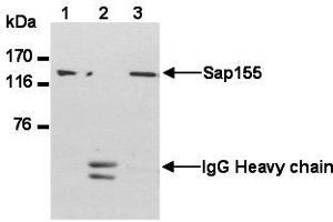Western Blotting (WB) image for anti-Splicing Factor 3b, Subunit 1, 155kDa (SF3B1) (AA 98-198) antibody (ABIN1449241) (SF3B1 antibody  (AA 98-198))