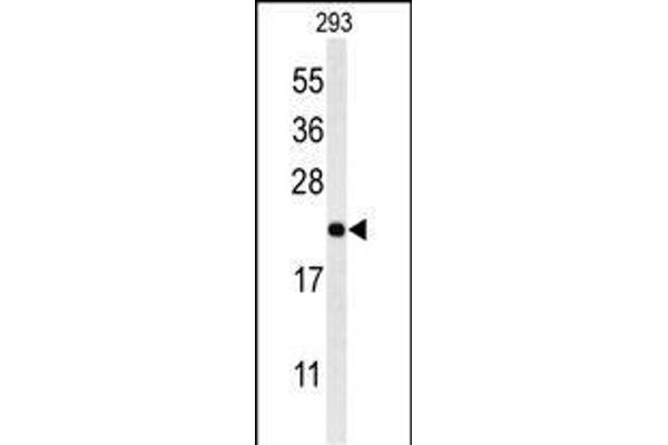MRAP antibody  (N-Term)