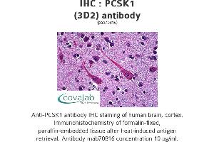 Image no. 1 for anti-Proprotein Convertase Subtilisin/kexin Type 1 (PCSK1) (AA 652-754) antibody (ABIN1723665) (PCSK1 antibody  (AA 652-754))