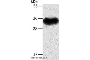 Western blot analysis of Mouse brain tissue, using STX1A Polyclonal Antibody at dilution of 1:600 (STX1A antibody)