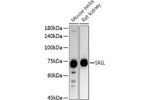 Western blot analysis of extracts of various cell lines, using SKIL antibody (ABIN6130691, ABIN6147811, ABIN6147812 and ABIN6221543) at 1:1000 dilution. (SKIL antibody  (AA 420-684))