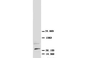 Anti-NGF antibody, Western blotting WB: Rat Brain Tissue Lysate (Nerve Growth Factor antibody  (N-Term))