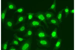 Immunofluorescence analysis of A549 cells using MPG antibody (ABIN5973138). (MPG antibody)