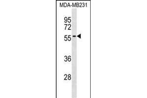 AK Antibody (Center) (ABIN1537769 and ABIN2838190) western blot analysis in MDA-M cell line lysates (35 μg/lane). (AKAP5 antibody  (AA 115-143))