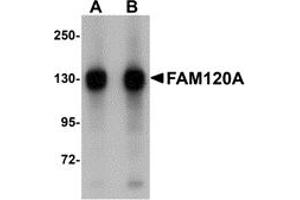 Western Blotting (WB) image for anti-Family with Sequence Similarity 120A (FAM120A) (Middle Region) antibody (ABIN1030930) (FAM120A antibody  (Middle Region))