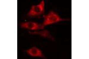 ABIN6274775 staining COLO205 cells by IF/ICC.