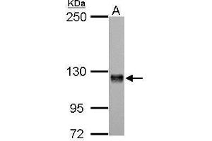WB Image Amphiphysin antibody [N1N2], N-term detects AMPH protein by Western blot analysis.