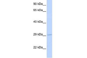 WB Suggested Anti-SLC25A6 Antibody Titration: 0. (SLC25A6 antibody  (N-Term))