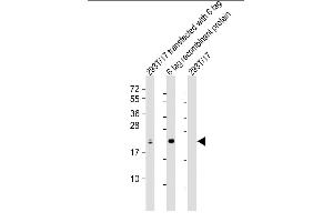 All lanes : Anti-S1 tag Antibody Antibody at 1:2000 dilution Lane 1: 293T/17 transfected with 6 tag lysate Lane 2: 6 tag recombinant protein lysate Lane 3: 293T/17 whole cell lysate Lysates/proteins at 20 μg per lane. (S1-Tag antibody)