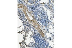 IHC analysis of VCL using anti-VCL antibody (ABIN7599003). (Vinculin antibody  (AA 1-149))