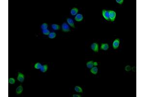 Immunofluorescence staining of PC-3 cells with ABIN7143116 at 1:100,counter-stained with DAPI. (ACTRT1 antibody  (AA 201-376))