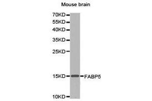 Western Blotting (WB) image for anti-Fatty Acid Binding Protein 5 (Psoriasis-Associated) (FABP5) antibody (ABIN1872637) (FABP5 antibody)