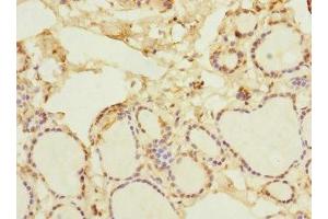 Immunohistochemistry of paraffin-embedded human thyroid tissue using ABIN7161528 at dilution of 1:100 (NFKBIE antibody  (AA 140-280))