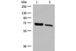 Western blot analysis of Human placenta tissue and Human fetal brain tissue lysates using TRIM8 Polyclonal Antibody at dilution of 1:500 (TRIM8 antibody)