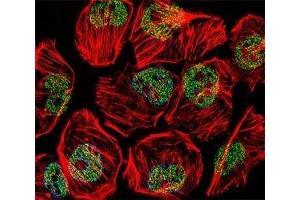 Fluorescent confocal image of U251 cell stained with TBP antibody at 1:25. (TBP antibody  (AA 210-239))