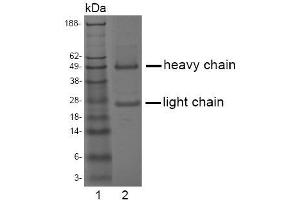 SDS-PAGE analysis of purified LT-3D1 monoclonalantibody. (ACPP antibody)