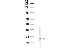 anti-RAB37, Member RAS Oncogene Family (RAB37) (C-Term) antibody