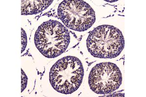 IHC analysis of PDK1 using anti-PDK1 antibody . (PDPK1 antibody  (AA 107-336))