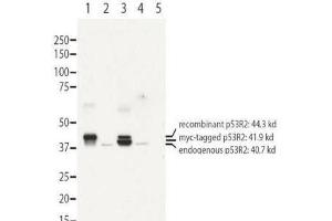 Western blot using  affinity purified anti-RRM2B antibody shows detection of recombinant (lanes 1 and 3) and endogenous protein (lanes 1 to 4) in whole cell extracts from transfected 293T. (RRM2B antibody  (N-Term))