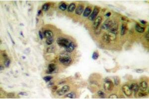 Image no. 1 for anti-Histone Deacetylase 10 (HDAC10) antibody (ABIN265454) (HDAC10 antibody)