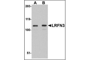 Western blot analysis of LRFN3 in K562 lysate with this product at (A) 1 and (B) 2 μg/ml.