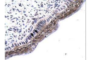 Image no. 1 for anti-TGF-beta Activated Kinase 1/MAP3K7 Binding Protein 2 (TAB2) (N-Term) antibody (ABIN6735781) (TAB2 antibody  (N-Term))