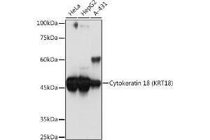 Western blot analysis of extracts of various cell lines, using Cytokeratin 18 (KRT18) Rabbit mAb (ABIN7268097) at 1:1000 dilution. (Cytokeratin 18 antibody)