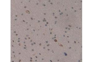 Used in DAB staining on fromalin fixed paraffin- embedded Kidney tissue (MEF2A antibody  (AA 1-162))