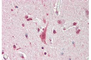 Rabbit Anti-Mxi1 antibody  Formalin Fixed Paraffin Embedded Tissue: Human Brain, Cortex Primary antibody Concentration: 1:200 Secondary Antibody: Donkey anti-Rabbit-Cy3 Secondary Antibody Concentration: 1:200 Magnification: 20x Exposure Time: 0. (MXI1 antibody  (N-Term))