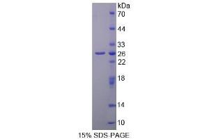 SDS-PAGE (SDS) image for Alanine Aminotransferase (ALT) (AA 720-961) protein (His tag) (ABIN2123958) (ALT Protein (AA 720-961) (His tag))